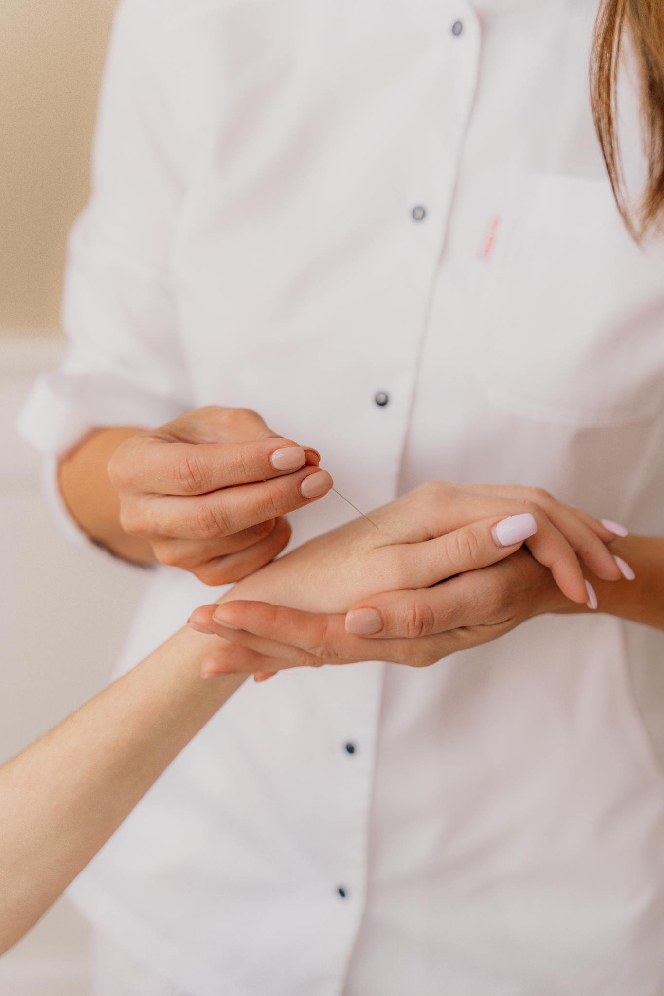 Acupuncturist carefully inserting needles into a patient's hand during therapy session.